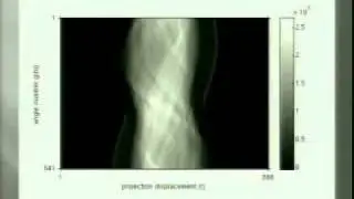 SURE2010: Helical CT Image Reconstruction