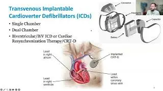 Ep3 Pacing Modes and NBG Codes - CVEF - Cardiac Device/EP Lecture Series