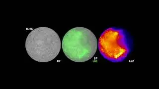 It's about time: a stem cell-derived model of the segmentation clock