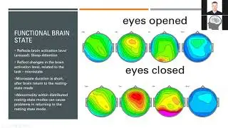 WEBINAR#1: Why you may want to add Functional Brain Mapping techniques to your practice