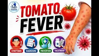 എന്താണ് തക്കാളിപനി: What is Tomato Fever /Tomato Flu - symptoms/ diagnosing/ prevention/treatment