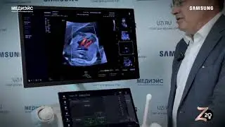 HERA Z20 обзор
