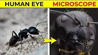 Things You Can See Only Under Microscope | Fact Minded
