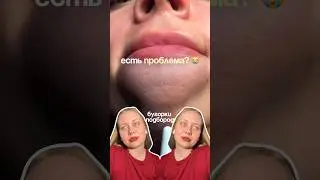 #WW173591 - арт на сыворотку для проблемной и комби кожи 🔥😍 #бьюти #обзор РП