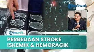 Jenis-jenis Stroke, Dokter Jelaskan Perbedaan hingga Penyebab Stroke Iskemik dan Stroke Hemoragik