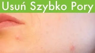 Skuteczny spos&oacute;b na  ROZSZERZONE I ZATKANE PORY