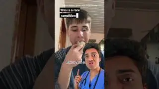 👀😱 ПРОБЛЕМА С ВЕКАМИ?! Врач реагирует на синдром Маркуса Ганна