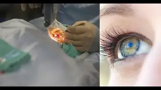 Future of human EYE, How we can fix eye issues in future,  See things with the help of computer....