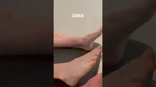 Talar Tilt Test #physicaltherapy #physiotherapist #education #ankle #shorts #injury