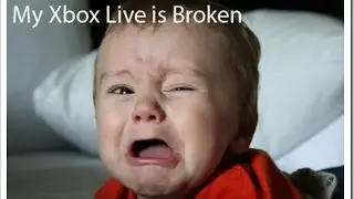 Xbox Live Down Forever? More Issues With Street Fighter V,  Surgery Sucks!