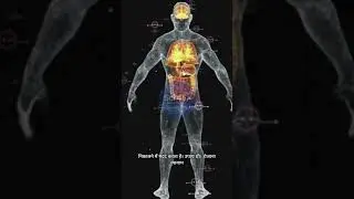 High Uric Acid Control Tips 🤔  | Gout Se Bachne Ke Gharelu Upay