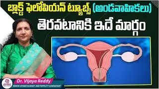 How to Open Blocked Tubes | Fallopian Tube Recanalization | Avira Fertility