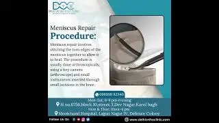 Unlock Pain-Free Living: Arthritis Meniscus Repair Procedure! #Orthopaedic