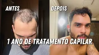 Opinião final: 1 ano de tratamento capilar com a Manual, deu tudo certo?