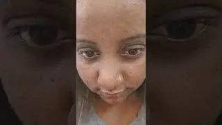 skin care