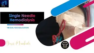 Single Needle Hemodialysis