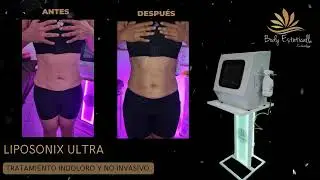 Liposonix ultra