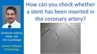 How can you check whether a stent has been inserted in the coronary artery?