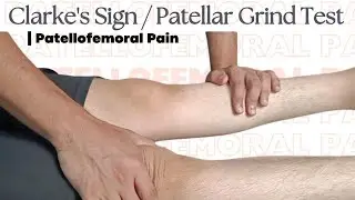 Clarke's Sign / Patellar Grind Test | Patellofemoral Pain