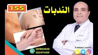 الندبات .. للدكتور محمد حسين - 155