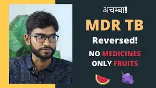 MDR-TB Reversed on Fruit Diet! | Pott's Spine Reversed Naturally | Full Story