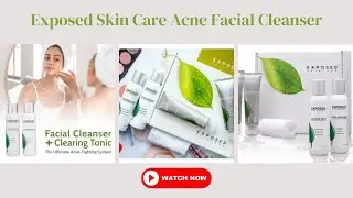Exposed Skin Care Acne Facial Cleanser