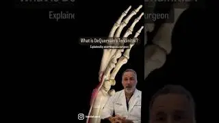 Что такое тендинит ДеКервена? Хирург-ортопед объясняет с помощью анимации.