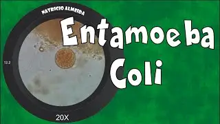Entamoeba coli - como reconhecer e diferenciar de Entamoeba histolytica