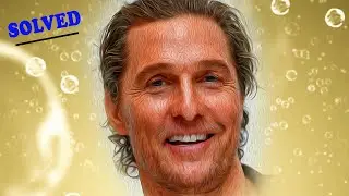 Matthew Mcconaughey hair transplant mystery SOLVED!
