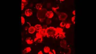 Targeting melanoma with scFv-immunoliposomes - Supplementary video 1 [96123]