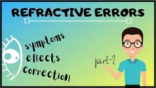 Refractive Errors | Errors of Refraction | Human Eye Refractive Errors (Part-2)