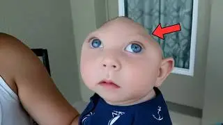 Scientists in Disbelief: This Boy Grows Brain After Being Born Without One