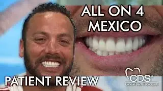 Surprising Transformation With All On 4 Fixed Hybrid Dentures in Mexico | CDS Cancun