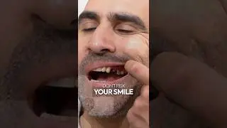 Dental Treatment Turkey | What Happens If You Don&rsquo;t Replace Missing Teeth?