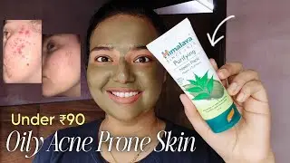 Himalaya Neem Purifying Face Pack Real Results & Review | Best Face Pack For Oily Acne Prone Skin