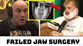 Jake Paul&rsquo;s Career in Serious Doubt After Botched Jaw Surgery Sparks Major Concern