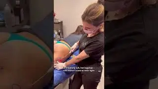 Cellu-later, butt and thigh dimples. 😉 We are loving #Aveli&mdash;a new, one-time treatment for cellulite.