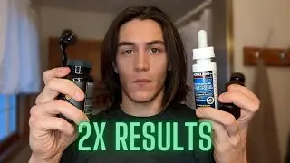 How to Double Beard Growth Results | Starting my Minoxidil & Derma Rolling Experiment