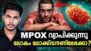 MPOX നമുക്ക് പണി ആകുമോ ?? MPOX EXPLAINED | MALAYALAM | AFWORLD BY AFLU