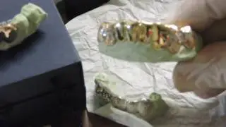 14K,18k,Platinum Custom Permanent Style Deep Cut Grillz by( DNF DIAMONDS)