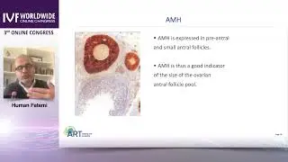 Tổng quan quan trọng về vai tr&ograve; của AMH trong y học sinh sản - Human Fatemi, UAE