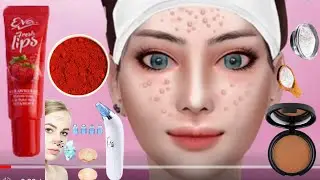 ASMR Hospital : Doctor Games &ndash; Best ASMR Video On Youtube - #acneremoval Acne Remove  -04