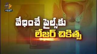Laser treatment for Piles | Sukhibhava | 8th June 2022 | ETV Andhra Pradesh