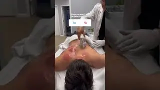 Have You Ever Tried Gliding Cupping?