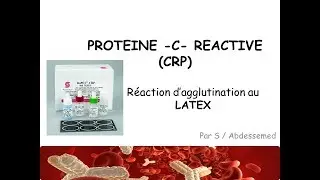 La Protéine-C- Réactive (Méthode d'agglutination au Latex)