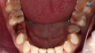 Дентальные имплантанты и протезирование. Капранов М. Ю. Клиника Dr. Smile