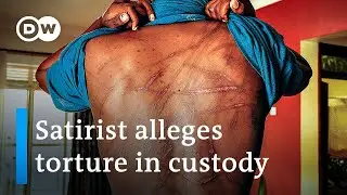 Uganda's government accused of human rights abuses, torture | DW News