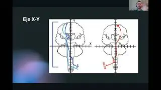3. Exploraci&oacute;n neurolog&iacute;ca. MPSS. Elliot