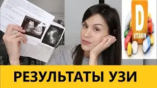 MY STORY/ VITAMIN D / ULTRASONOGRAPHY RESULTS / PROBLEMS WITH THE PANCREAS / ADVANTAGES OF LAPARO...