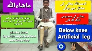 Below knee prosthesis total plastic Artificial leg  imported foot with imported knee cap #leg #limb